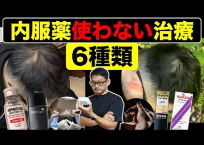 【薄毛改善】内服薬以外の治療法6種類【日本皮膚科学科ガイドライン解説】