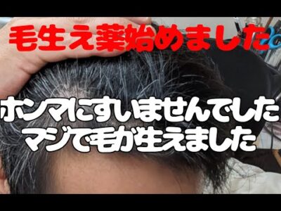 【毛生え薬】疑ってすみませんでした！！フィナクス＆ミノクソールでマジで生えてきました！
