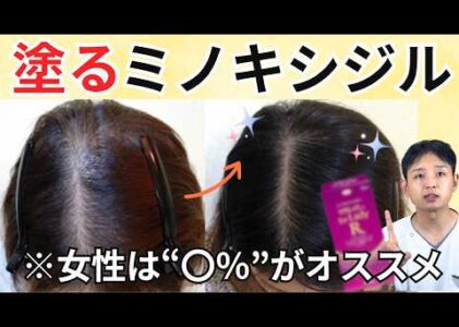 女性がミノキシジルの外用薬(塗り薬)を使うなら5%？効果と副作用から〇％をオススメします