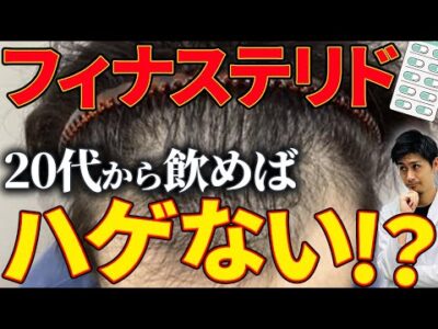 【AGA治療薬】フィナステリドは若いうちから飲んでおけばハゲないって本当？
