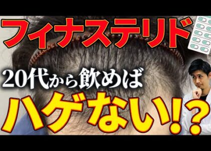 【AGA治療薬】フィナステリドは若いうちから飲んでおけばハゲないって本当？