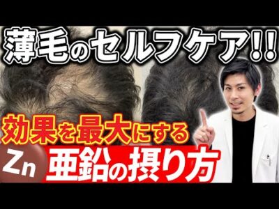 亜鉛を最大限に活かす方法って？プロの医師が解説します！【AGA/薄毛改善/ハゲ】