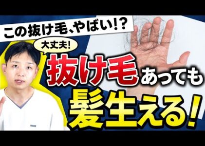 抜け毛で不安な人に聞いてほしい話