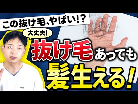 抜け毛で不安な人に聞いてほしい話