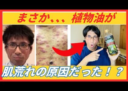 植物油をやめたらアトピー・肌荒れが劇的改善！