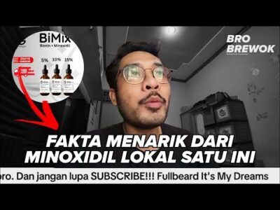 SEBERAPA BAGUS MINOXIDIL LOKAL INI??? |  BIMIX MINOXIDIL 5%