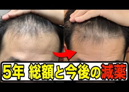 【AGA 治療 費用】5年間の総額と今後の減薬について【クリニック38社の価格整理】