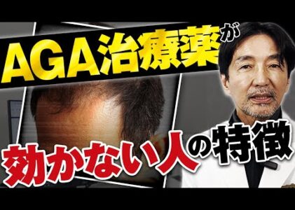 【徹底解説】AGA治療薬が効かない人の特徴、原因について