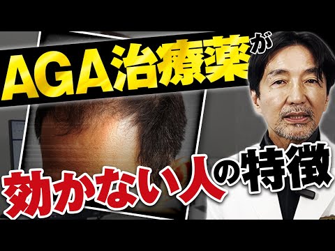 【徹底解説】AGA治療薬が効かない人の特徴、原因について