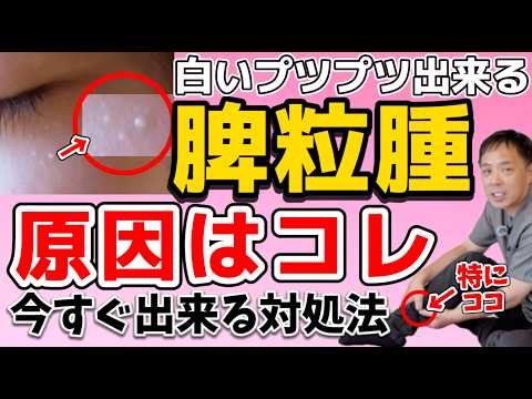 【稗粒腫の原因 】皮膚科・薬で消えない人必見！東洋医学で根本改善する方法