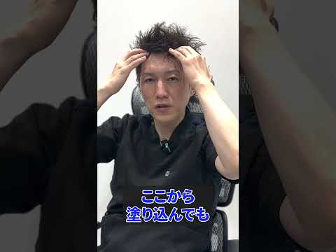 薄毛に対して塗り薬と飲み薬はどっちが良い？　#shorts